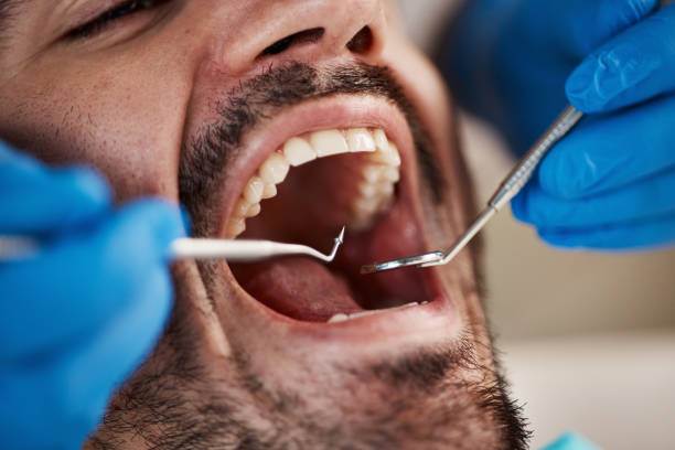 Best Broken or Chipped Tooth Repair in Chimayo, NM