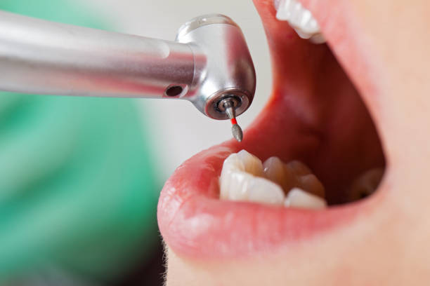 Best Emergency Treatment for Jaw Pain or Injury in Chimayo, NM